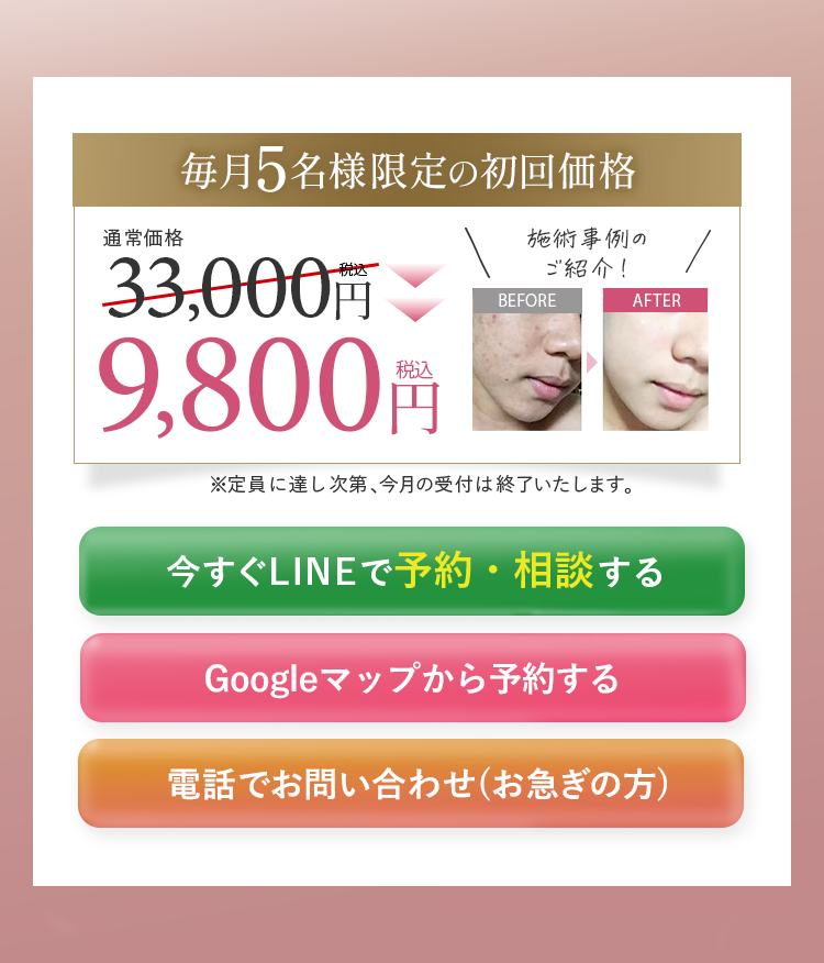 毎月5名様限定の初回価格 9,800円