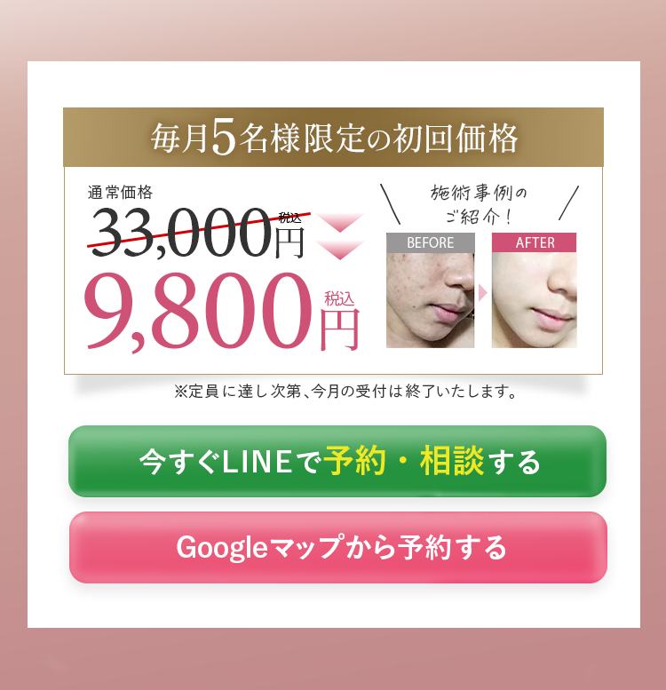 毎月5名様限定の初回価格 9,800円